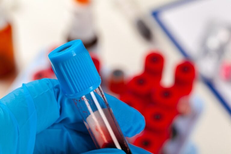Blue-gloved hand holding a capped blood sample tube against a blurred laboratory background